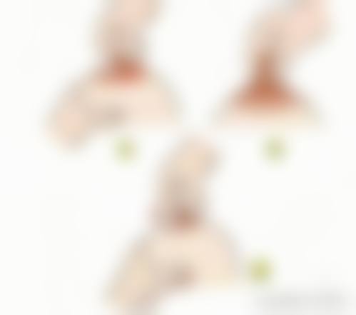 汕头悦美整形医疗美容资质