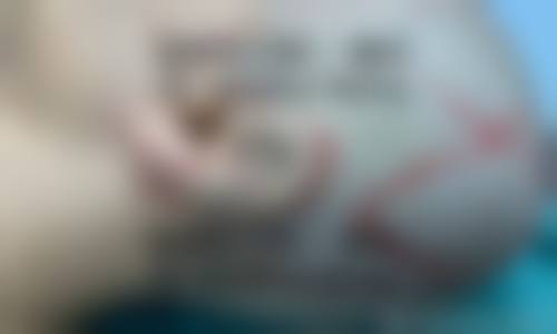 四、东莞塘厦贝芙丽整形医院怎么样——项目特色