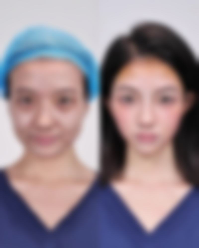 彭华伟医生简介做手术价格