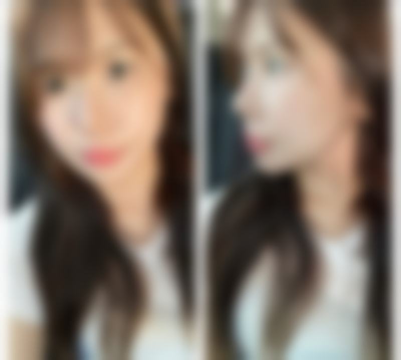 武汉熙颜医疗美容门诊部价格表