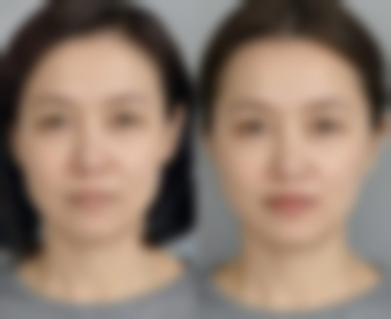 侯雅楠医生顾客实例图片