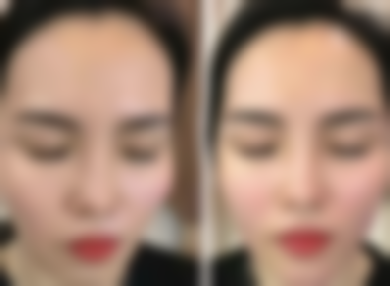 贵州凯婷凯钥医疗美容门诊部怎么样:更擅长什么