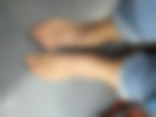 手术前后的注意事项：精心准备与细心呵护