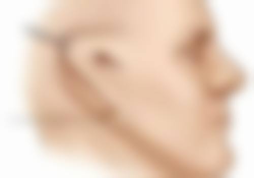 包头医学校第二附属医院医学美容整形科口碑评价如何？