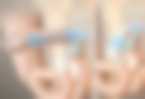 割双眼皮要肿多久：不同类型医院消肿时间对比