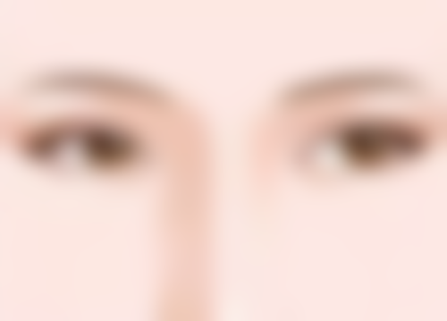 开眼角可以和双眼皮手术一起做吗？内眦赘皮矫正+重睑术效果翻倍，恢复期缩短30%