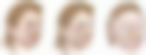 哺乳后多久可以隆胸？断奶后6个月+乳腺恢复良好是关键