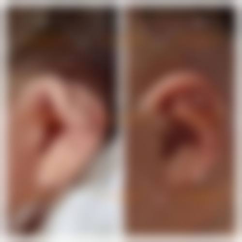 安阳金莱美医疗美容诊所更擅长什么手术