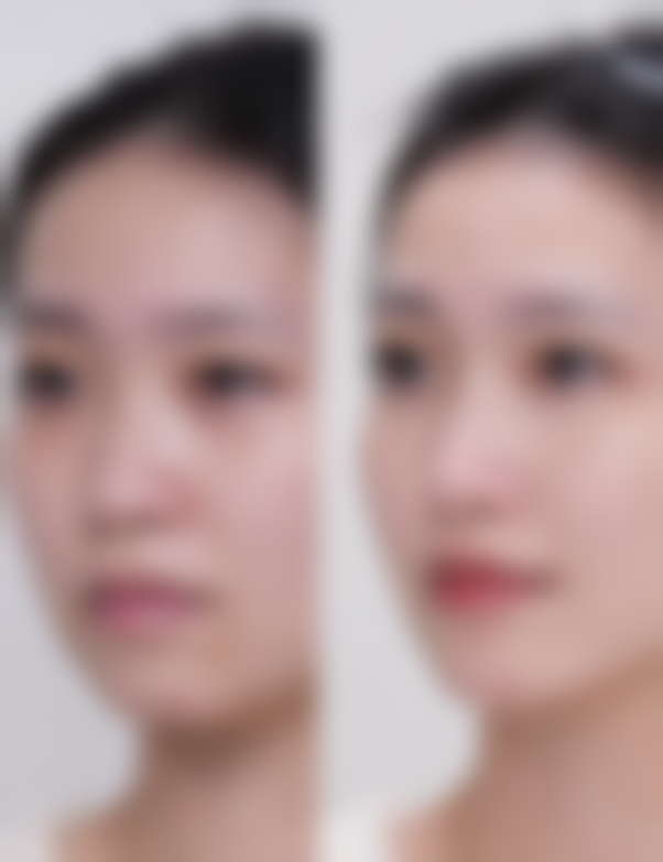 青岛市正规医美医院排名前十——青岛壹美天成整形美容医院