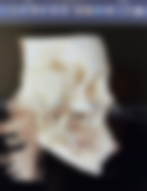 压力疗法：物理性的“温柔镇压”