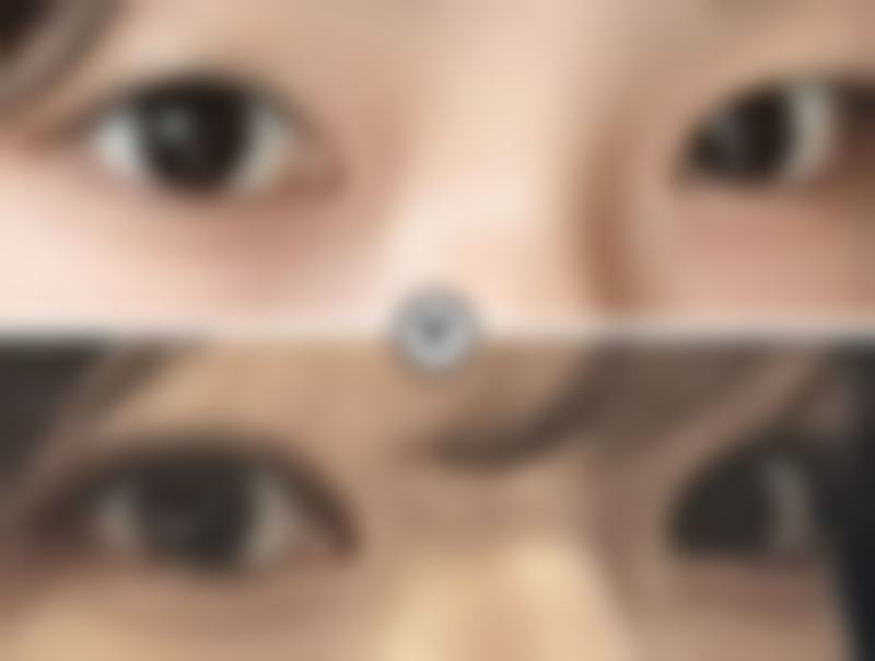 杭州悦可医疗美容诊所陈彩媛坐诊医院实力雄厚