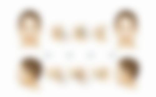 割双眼皮多久可以修复高蛋白饮食