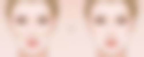 医生技术：专精水准对植入双眼皮恒久性的作用