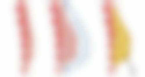 帅楠眼袋贴副作用之初级症状揭秘