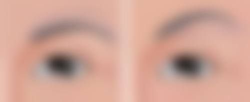 帅楠眼袋贴副作用自救之立即行动