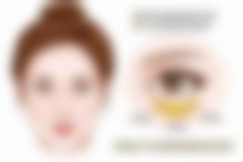 帅楠眼袋贴副作用之进阶翻车现象