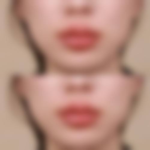 金华市新美医疗美容门诊部更擅长什么