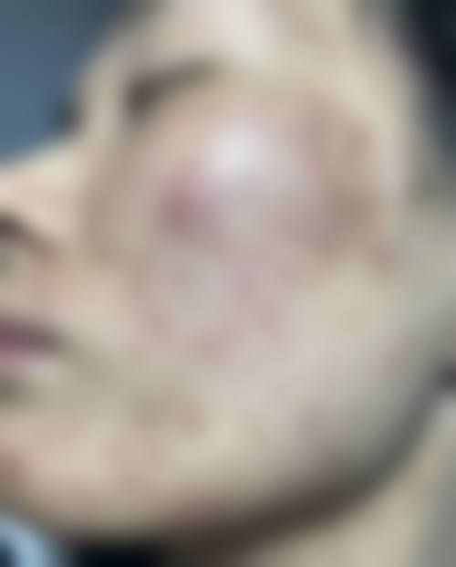 合肥壹美尚整形美容医院口碑好不好？附真实患者口碑评价