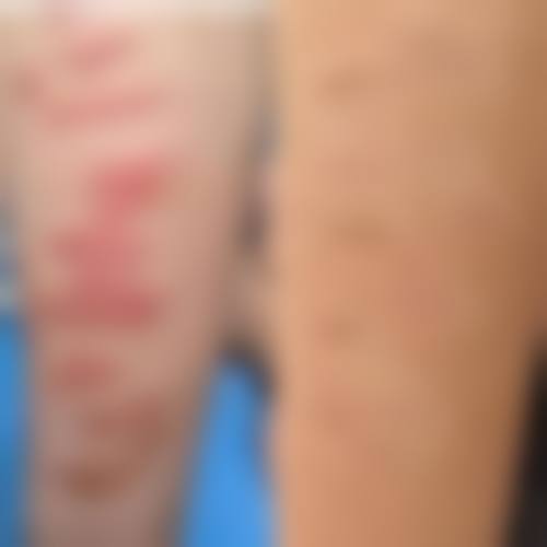 PichetRodchareon医生简介做手术价格