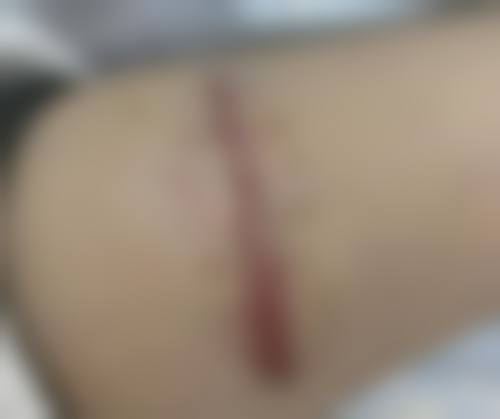 镇江兰桂坊整形医疗美容诊所价格表