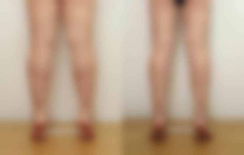 韩国sage医院李敬秀的擅长领域——韩国respect整形外科