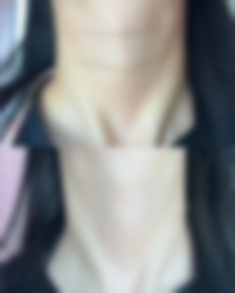 隆鼻鼻头有点歪，医院揭秘常见原因