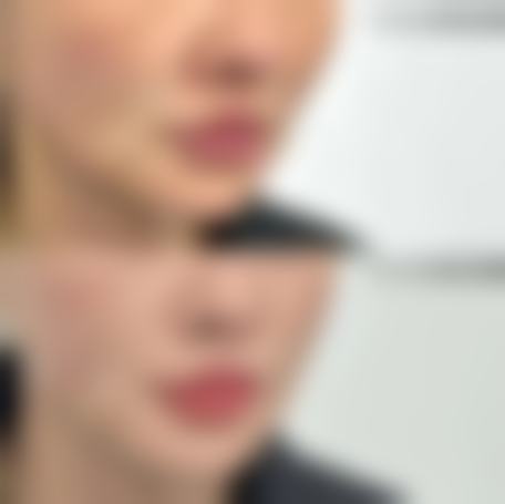 南京佑越婷整形医院真实患者口碑评价