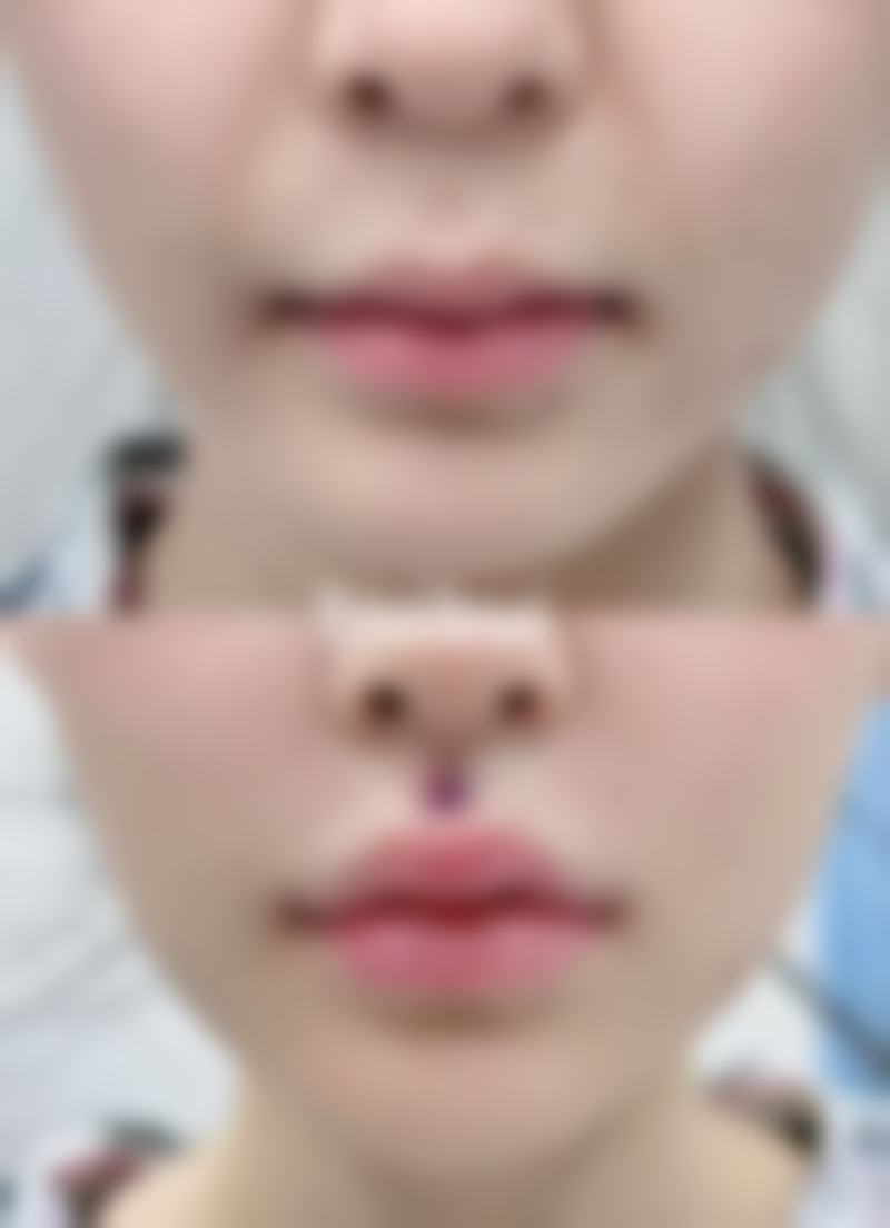 海南三亚维多利亚医疗美容医院口碑好不好?附真实患者口碑评价