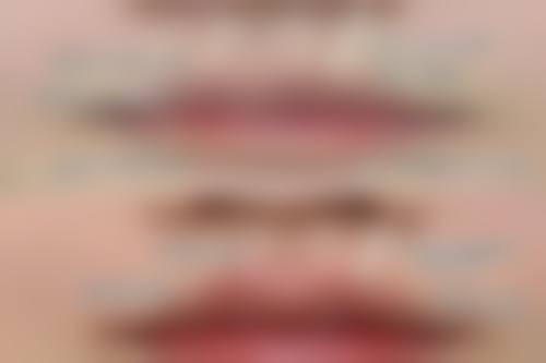 打瘦脸针吃柚子对成效的影响：正确食用无担忧