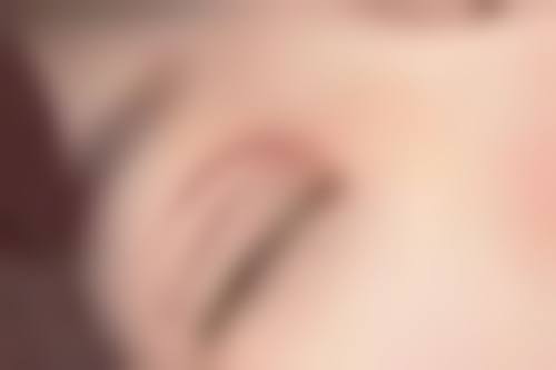 硅胶假体隆胸更换时要注意什么