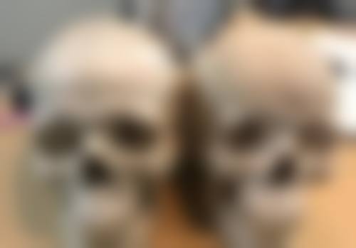 烫伤疤痕十几年了修复需要多少钱