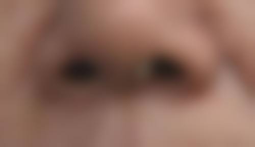 南通英莎医疗美容门诊部李辉术后护理与随访关怀