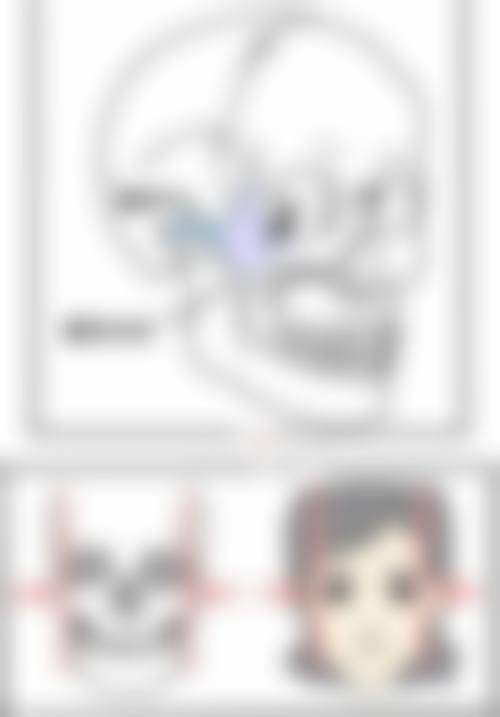 做眼袋手术什么年龄合适——男性篇