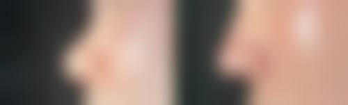 北京协和医院：国有医院面部拉皮除皱的“抗衰航母”