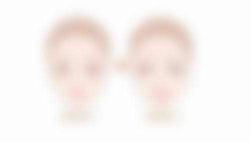 林奇医生做手术价格