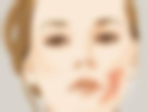 做眼袋手术什么年龄合适——女性篇