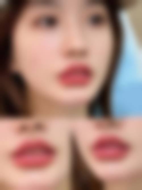 湖州吴兴曙光威兹曼医疗美容医院求美者如何判断自己适合胡医生的项目之适应症与禁忌症分析