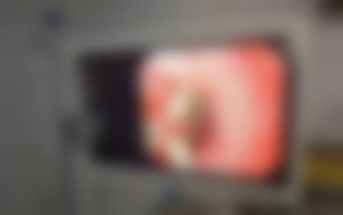 袁超英医生顾客实例图片