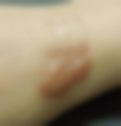 大庆陈云生整形医疗美容诊所价格表