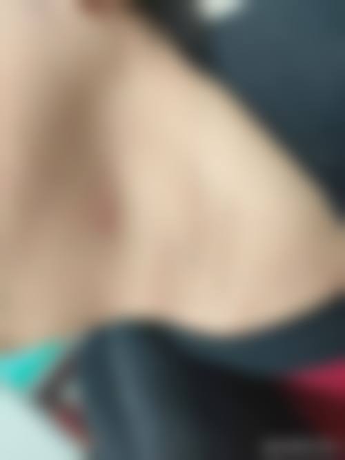 横割皮肤科诊所怎么样价格表