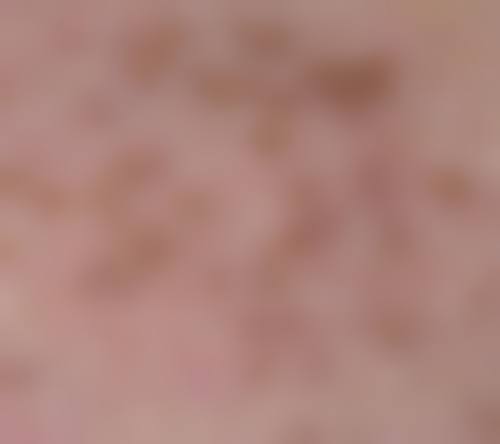 王国光医生简介做手术价格