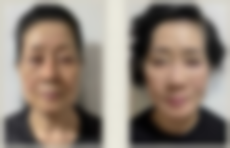 陈志明医生简介做手术价格