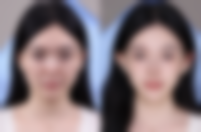 南通英莎医美【全切双眼皮与眼袋外切二选一特别优惠 10000】未来发展前景