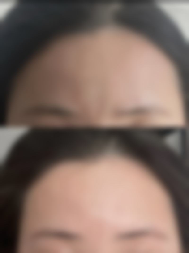 香港SWISS O Beauty Expert整形抖音团购活动有哪些,价格表