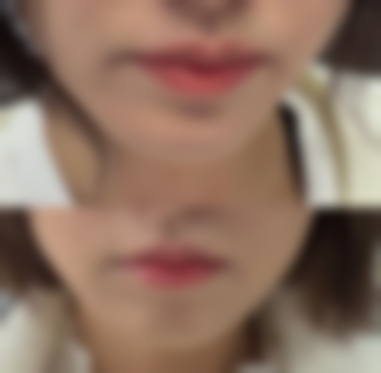 厦门美莱医疗美容的抖音团购活动及价格表