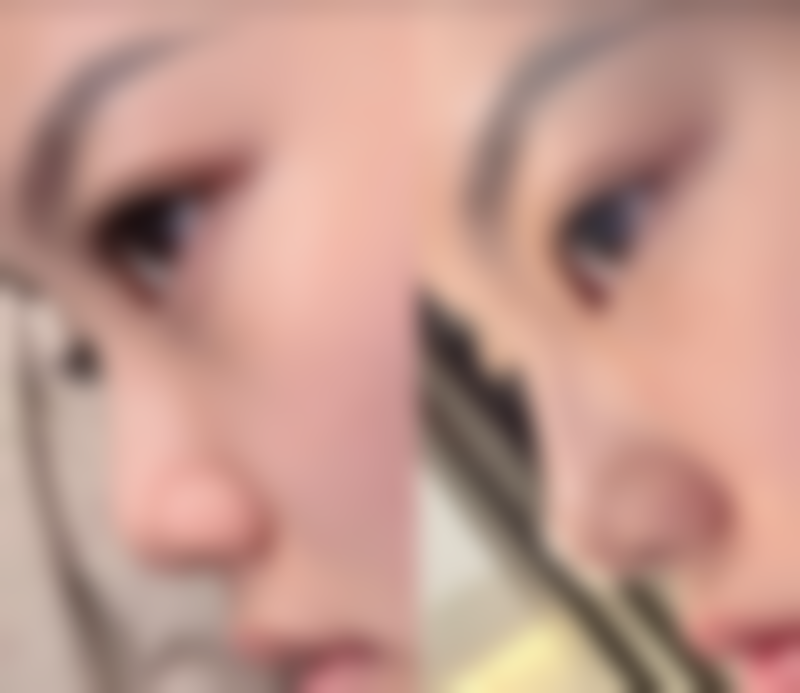 汕头大学医学校第一附属医院整形美容外科地址及乘车路线