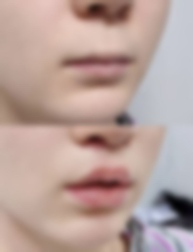 陈志明医生简介口碑如何