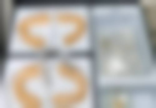 做完吸脂手术多久可以喝酒？腹部大腿面部恢复期大不同，医生建议收藏！