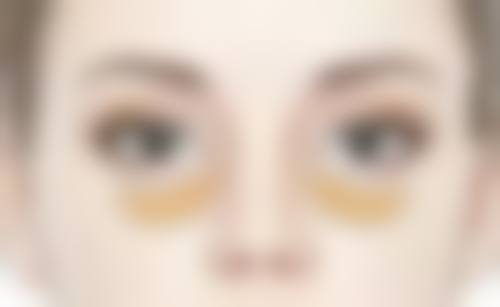 男士去眼袋方法有哪些:运动——汗水换来的明亮双眸