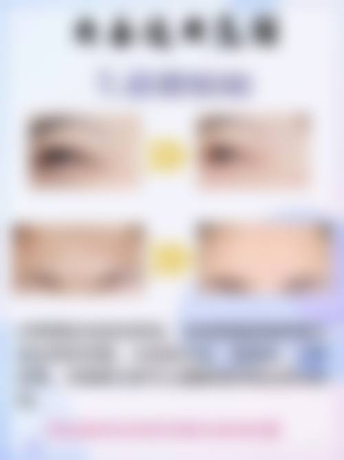 眼袋发黑怎么调理？3招中医按摩+5种饮食调理告别熊猫眼